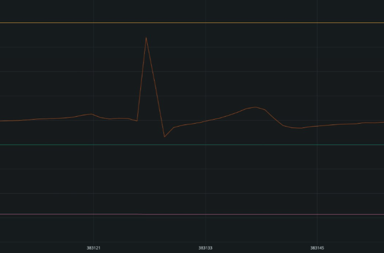 ECG waveform captured during testing of the team’s prototype